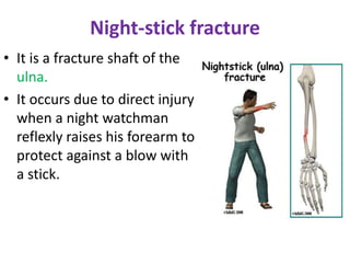 Night-stick fracture
• It is a fracture shaft of the
ulna.
• It occurs due to direct injury
when a night watchman
reflexly raises his forearm to
protect against a blow with
a stick.
 