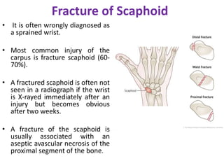 Fracture of Scaphoid
• It is often wrongly diagnosed as
a sprained wrist.
• Most common injury of the
carpus is fracture scaphoid (60-
70%).
• A fractured scaphoid is often not
seen in a radiograph if the wrist
is X-rayed immediately after an
injury but becomes obvious
after two weeks.
• A fracture of the scaphoid is
usually associated with an
aseptic avascular necrosis of the
proximal segment of the bone.
 
