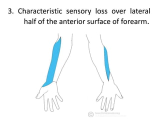 3. Characteristic sensory loss over lateral
half of the anterior surface of forearm.
 