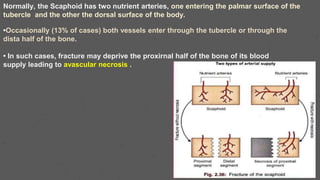 Normally, the Scaphoid has two nutrient arteries, one entering the palmar surface of the
tubercle and the other the dorsal surface of the body.
•Occasionally (13% of cases) both vessels enter through the tubercle or through the
dista half of the bone.
• In such cases, fracture may deprive the proxirnal half of the bone of its blood
supply leading to avascular necrosis .
 