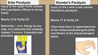 Erbs Paralysis Klumke’s Paralysis
Injury to the upper trunk causes
Erb’s paralysis.( Where 6 nerves
meet)
Mainly C5 & Partly C6 .
Deformity :- Arm: Hangs by the
side; it is adducted and medially
rotated. Forearm: Extended and
pronated
Injury to the Lower trunk causes
Klumpke's paralysis.
Mainly T1 & Partly C8.
Claw hand there is hyperextension
at the metacarpophalangeal joints
and flexion at the interphalangeal
joints.
 