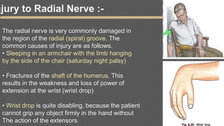 njury to Radial Nerve :-
The radial nerve is very commonly damaged in
the region of the radial (spiral) groove. The
common causes of injury are as follows.
• Sleeping in an armchair with the limb hanging
by the side of the chair (saturday night palsy)
• Fractures of the shaft of the humerus. This
results in the weakness and loss of power of
extension at the wrist (wrist drop)
• Wrist drop is quite disabling, because the patient
cannot grip any object firmly in the hand without
The action of the extensors.
 