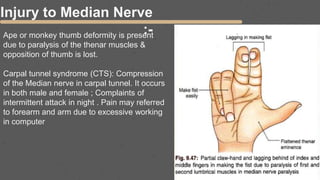 Injury to Median Nerve
:-
Ape or monkey thumb deformity is present
due to paralysis of the thenar muscles &
opposition of thumb is lost.
Carpal tunnel syndrome (CTS): Compression
of the Median nerve in carpal tunnel. It occurs
in both male and female ; Complaints of
intermittent attack in night . Pain may referred
to forearm and arm due to excessive working
in computer
 