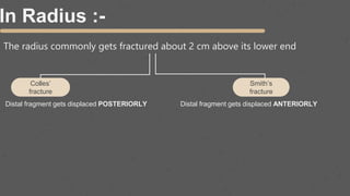 In Radius :-
The radius commonly gets fractured about 2 cm above its lower end
Colles’
fracture
Smith’s
fracture
Distal fragment gets displaced ANTERIORLY
Distal fragment gets displaced POSTERIORLY
 