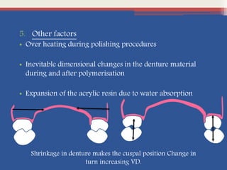 5. Other factors
• Over heating during polishing procedures
• Inevitable dimensional changes in the denture material
during and after polymerisation
• Expansion of the acrylic resin due to water absorption
Shrinkage in denture makes the cuspal position Change in
turn increasing VD.
 
