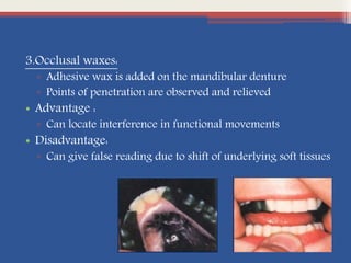 3.Occlusal waxes:
▫ Adhesive wax is added on the mandibular denture
▫ Points of penetration are observed and relieved
• Advantage :
▫ Can locate interference in functional movements
• Disadvantage:
▫ Can give false reading due to shift of underlying soft tissues
 