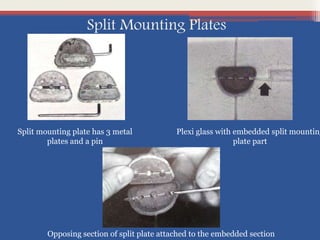 Split Mounting Plates
Plexi glass with embedded split mounting
plate part
Split mounting plate has 3 metal
plates and a pin
Opposing section of split plate attached to the embedded section
 