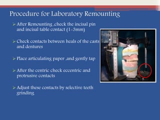 Procedure for Laboratory Remounting
After Remounting ,check the incisal pin
and incisal table contact (1-3mm)
Check contacts between heals of the casts
and dentures
Place articulating paper ,and gently tap
After the centric check eccentric and
protrusive contacts
Adjust these contacts by selective teeth
grinding
 