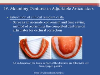 IV. Mounting Dentures in Adjustable Articulators
• Fabrication of clinical remount casts:
▫ Serve as an accurate, convenient and time saving
method of reorienting the completed dentures on
articulator for occlusal correction
▫
All undercuts on the tissue surface of the dentures are filled with wet
tissue paper, pumice
Steps for clinical remounting
 