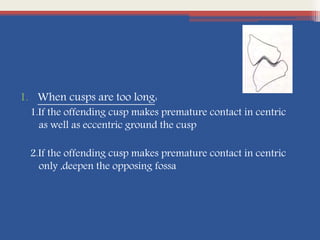 1. When cusps are too long:
1.If the offending cusp makes premature contact in centric
as well as eccentric ground the cusp
2.If the offending cusp makes premature contact in centric
only ,deepen the opposing fossa
 