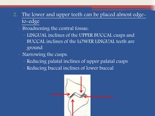 2. The lower and upper teeth can be placed almost edge-
to-edge
▫ Broadnening the central fossae:
 LINGUAL inclines of the UPPER BUCCAL cusps and
BUCCAL inclines of the LOWER LINGUAL teeth are
ground
▫ Narrowing the cusps:
 Reducing palatal inclines of upper palatal cusps
 Reducing buccal inclines of lower buccal
 