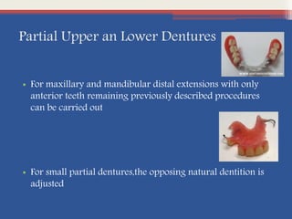 Partial Upper an Lower Dentures
• For maxillary and mandibular distal extensions with only
anterior teeth remaining previously described procedures
can be carried out
• For small partial dentures,the opposing natural dentition is
adjusted
 