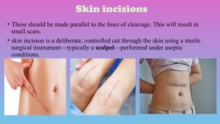 Skin Paddle Incision clinical antomy of skin and fascia with clinical features and imeges | PPTX