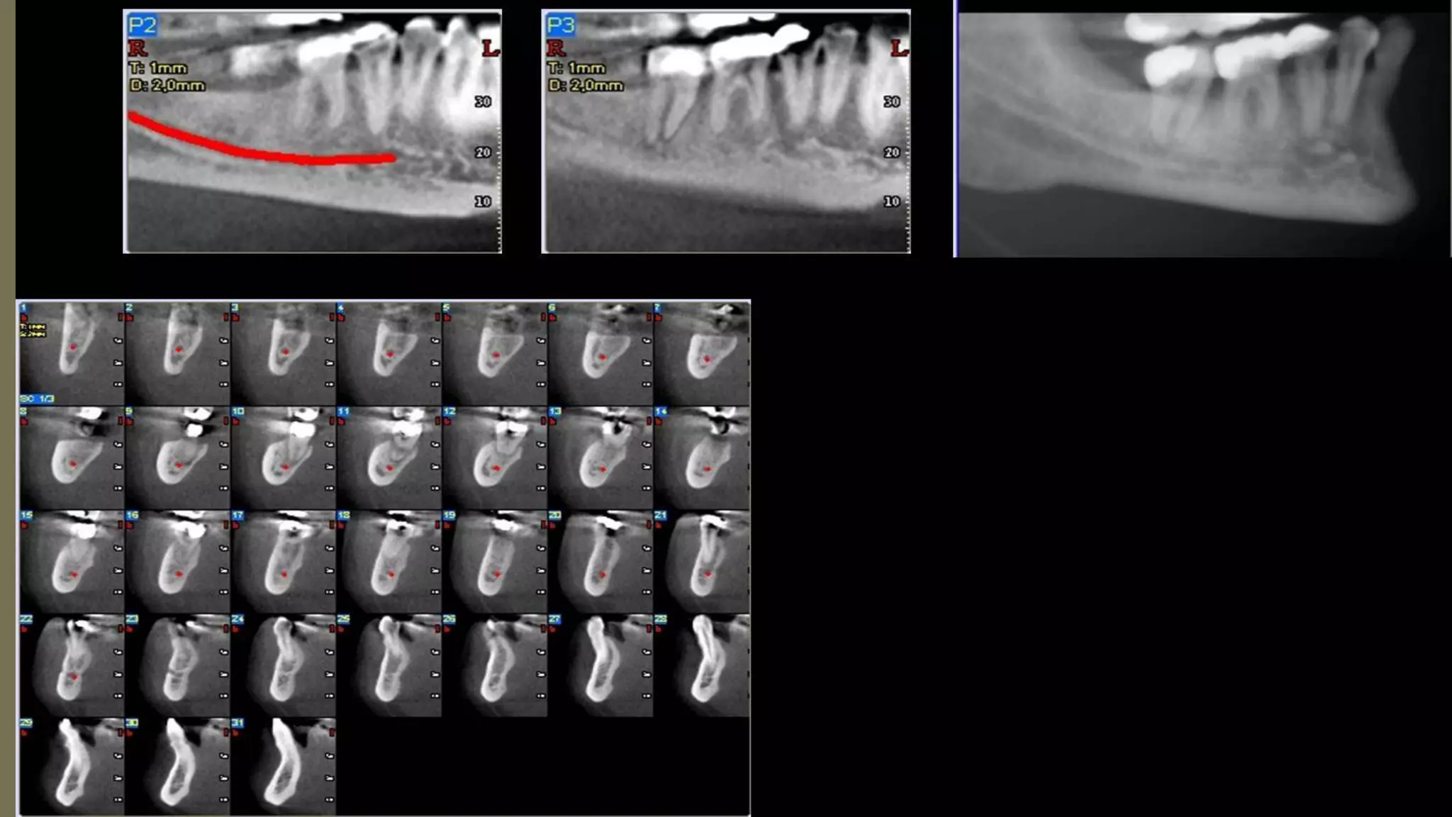 Clinical applications of CBCT | PPTX