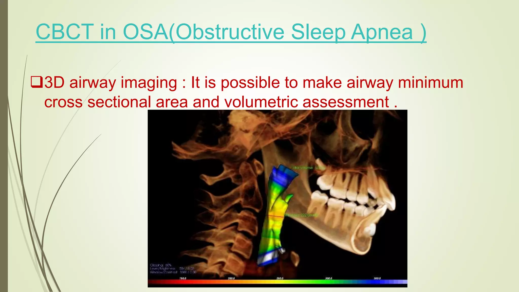 Clinical applications of CBCT | PPTX