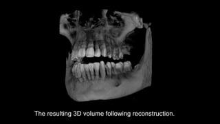 Clinical applications of CBCT | PPTX
