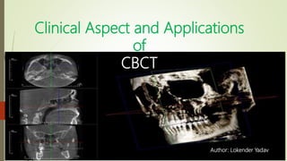 Clinical Aspect and Applications
of
CBCT
Author: Lokender Yadavwww.lokender.in
 