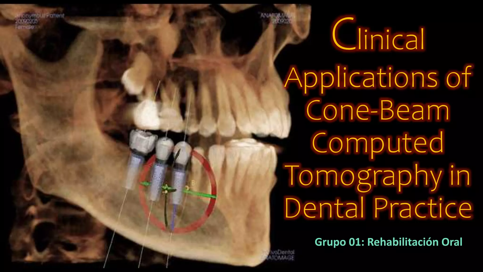 Clinical Applications of Cone-Beam Computed Tomography in Dental.pptx
