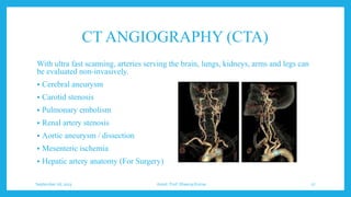 CT ANGIOGRAPHY (CTA)
With ultra fast scanning, arteries serving the brain, lungs, kidneys, arms and legs can
be evaluated non-invasively.
 Cerebral aneurysm
 Carotid stenosis
 Pulmonary embolism
 Renal artery stenosis
 Aortic aneurysm / dissection
 Mesenteric ischemia
 Hepatic artery anatomy (For Surgery)
September 26, 2023 Assist. Prof. Dheeraj Kumar 27
 