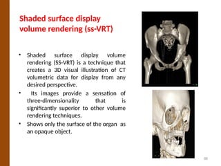 Clinical Applications of MDCT by joginder.pptx