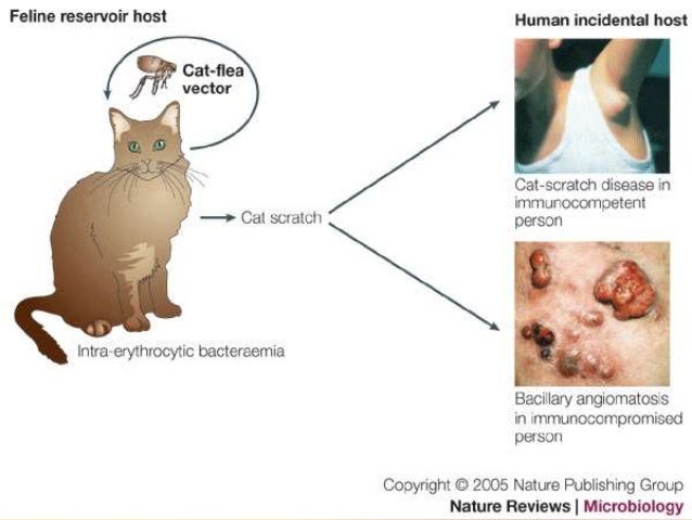 Chronic Cat Scratch Disease Chronic Cat Scratch Disease