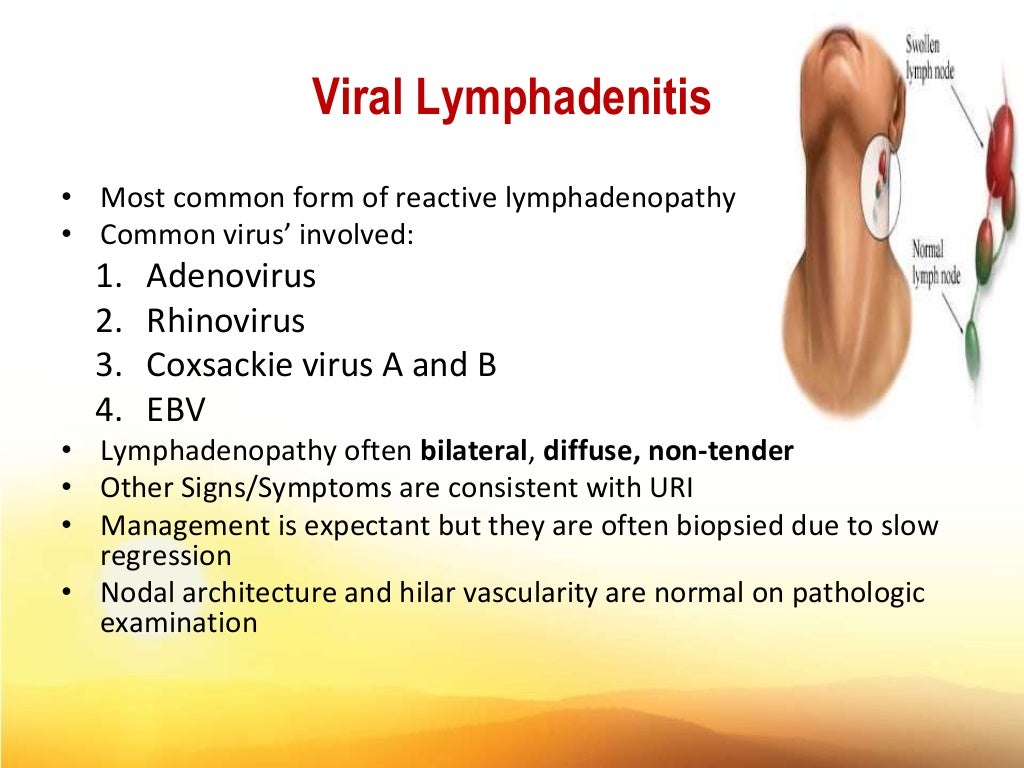 Clinical approach fever +lymphadenopathy