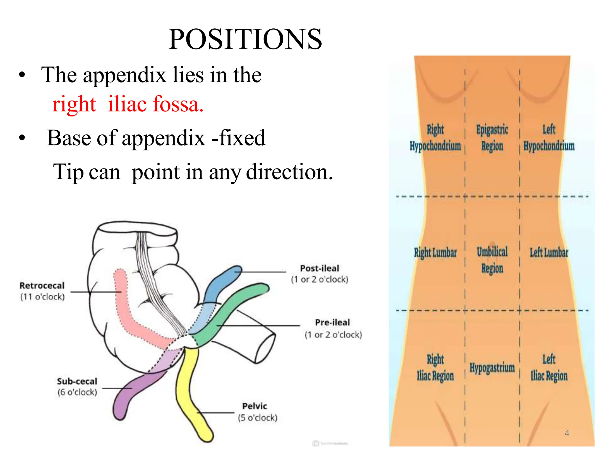 Appendix Position CLINICAL APPROACH TO APPENDISECTOMY.pptx