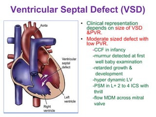 Vsd Size Classification Clinical approach to congenital heart disease diagnosis | PPT