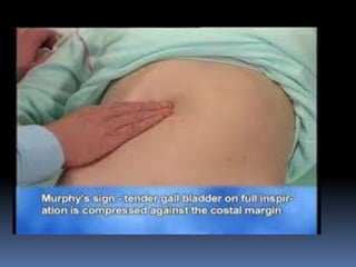 Murray Sign Clinical approach to gynaecological patient (part 2) | PPTX