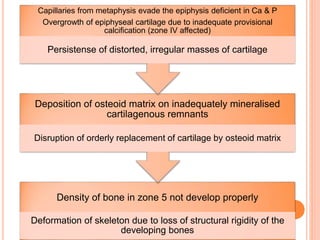 Clinical approach to rickets with special reference to renal rickets ...