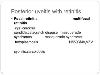 Posterior uveitis with retinitis
 Focal retinitis multifocal
retinitis
cysticercosis
candida,catscratch disease masquerade
syndromes masquerade syndrome
toxoplasmosis HSV,CMV,VZV
syphilis,sarcoidosis
 