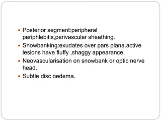  Posterior segment:peripheral
periphlebitis,perivascular sheathing.
 Snowbanking:exudates over pars plana.active
lesions have fluffy ,shaggy appearance.
 Neovascularisation on snowbank or optic nerve
head.
 Subtle disc oedema.
 