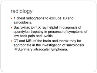 radiology
 1.chest radiographs:to exclude TB and
sarcoidosis.
 Sacro-iliac joint X ray:helpful in diagnosis of
spondyloartropathy in presence of symptoms of
low back pain and uveitis.
 CT and MRI:of the brain and thorax may be
appropriate in the investigation of sarcoiodsis
,MS,primary intraocular lymphoma.
 