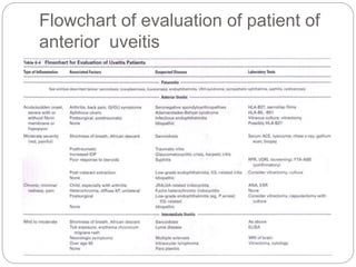 Flowchart of evaluation of patient of
anterior uveitis
 