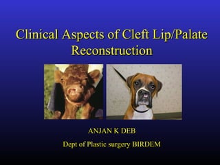 Clinical Aspects of Cleft Lip/PalateClinical Aspects of Cleft Lip/Palate
ReconstructionReconstruction
ANJAN K DEBANJAN K DEB
Dept of Plastic surgery BIRDEMDept of Plastic surgery BIRDEM
 