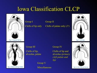 Clinical aspects of cleft lip & palate reconstruction | PPT