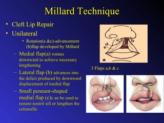Clinical aspects of cleft lip & palate reconstruction | PPT