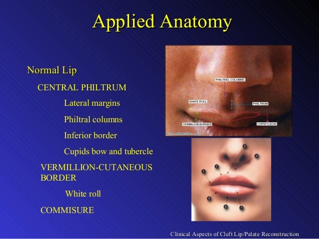 [Image: clinical-aspects-of-cleft-lip-palate-rec...1378652885]
