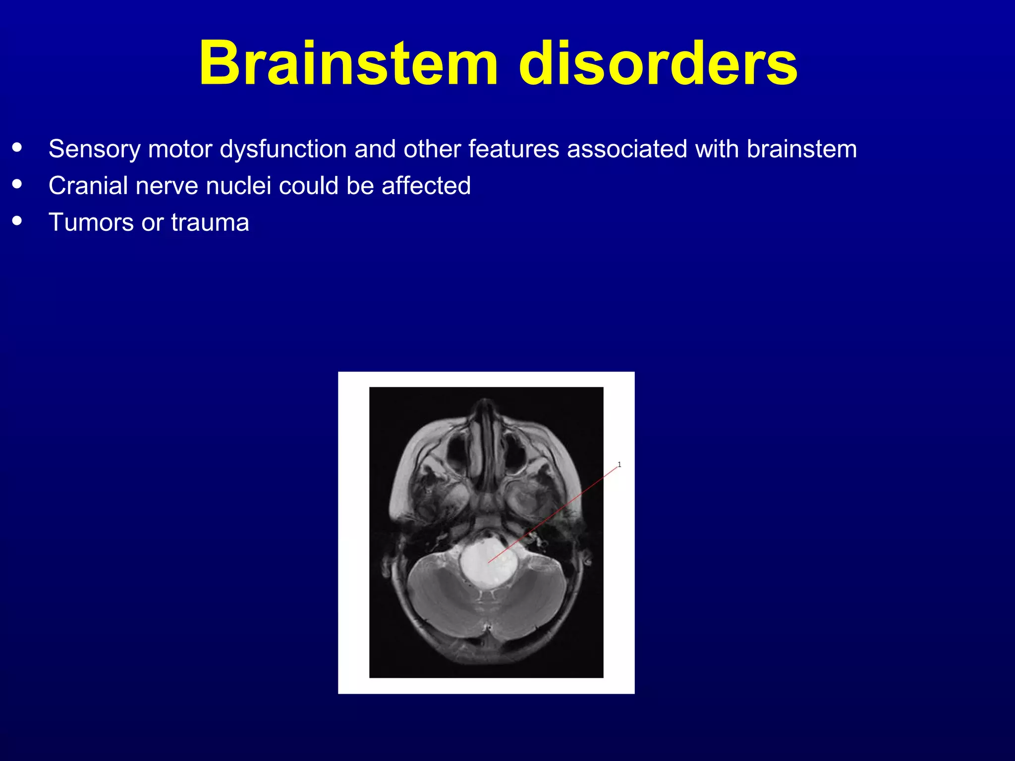 Brainstem disorders 
• Sensory motor dysfunction and other features associated with brainstem 
• Cranial nerve nuclei could be affected 
• Tumors or trauma 
 