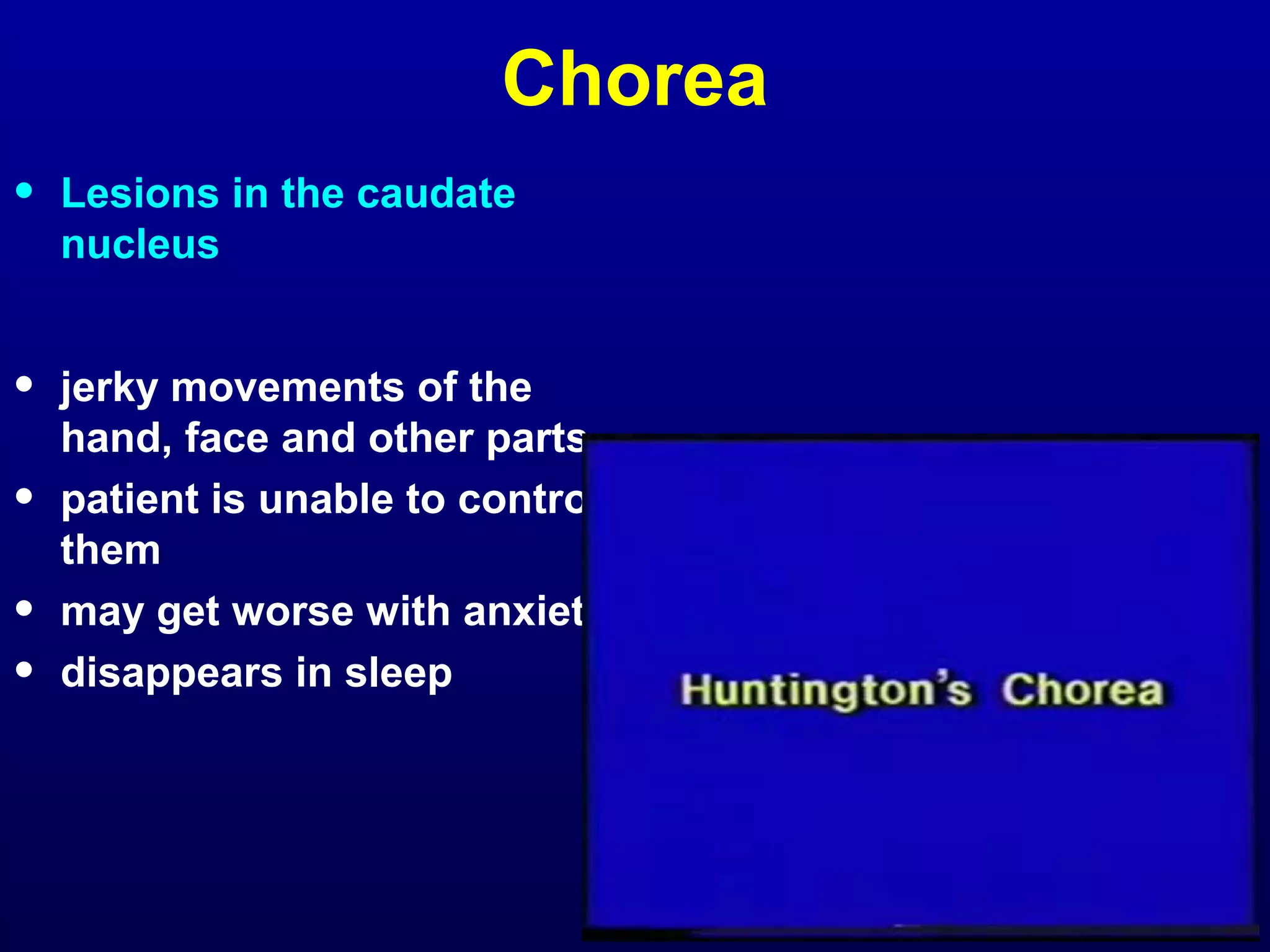 Chorea 
• Lesions in the caudate 
nucleus 
• jerky movements of the 
hand, face and other parts 
• patient is unable to control 
them 
• may get worse with anxiety 
• disappears in sleep 
 