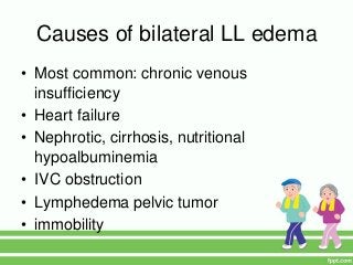 Causes of bilateral LL edema
• Most common: chronic venous
insufficiency
• Heart failure
• Nephrotic, cirrhosis, nutritional
hypoalbuminemia
• IVC obstruction
• Lymphedema pelvic tumor
• immobility
 