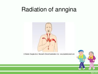 Radiation of anngina
 