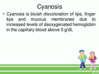 Cyanosis
• Cyanosis is bluish discoloration of lips, finger
tips and mucous membranes due to
increased levels of deoxygenated hemoglobin
in the capillary blood above 5 g/dL
 