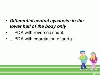 • Differential central cyanosis: in the
lower half of the body only
• PDA with reversed shunt.
• PDA with coarctation of aorta.
 