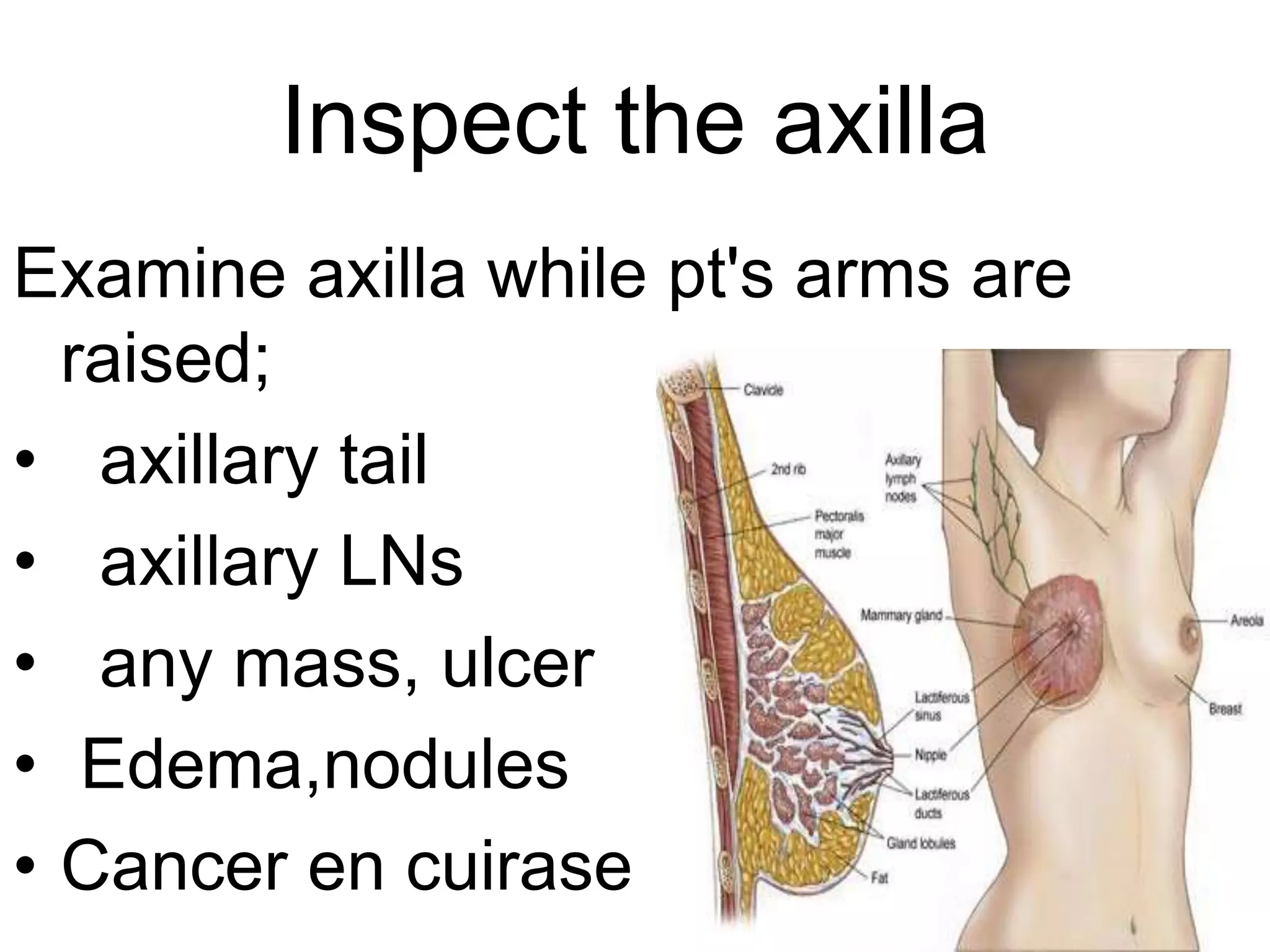 Clinical assessment of breast | PPTX