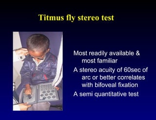 Timus Test Clinical Assessment of Strabismus and evaluation technique | PPT