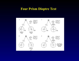 Clinical Assessment of Strabismus and evaluation technique | PPT