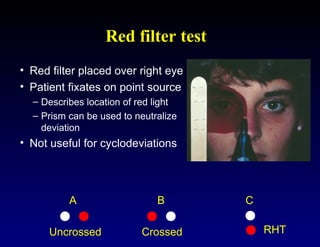 Red Filter Example Clinical Assessment of Strabismus and evaluation technique | PPT