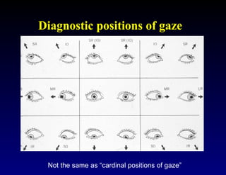 Clinical Assessment of Strabismus and evaluation technique | PPT