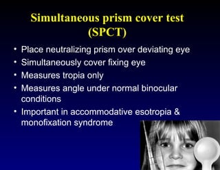 Clinical Assessment of Strabismus and evaluation technique | PPT